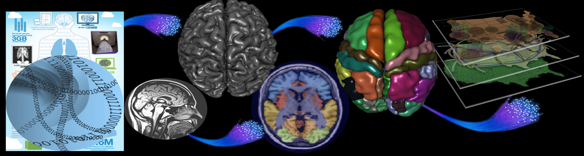 Udall Parkinson Disease Research Center